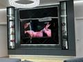 4-бөлмелі пәтер · 104 м² · 17/18 қабат, Абая 164 — Брусиловского, бағасы: 85 млн ₸ в Алматы, Бостандыкский р-н — фото 2