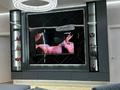 4-бөлмелі пәтер · 104 м² · 17/18 қабат, Абая 164/3 — Брусиловского, бағасы: 85 млн ₸ в Алматы, Бостандыкский р-н — фото 2